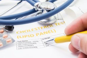 General practitioner cholesterol test results
