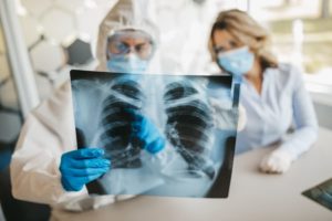 Physicians looking at lung X-ray to look for pneumonia
