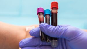 Nurse holding blood test vials in gloved hand